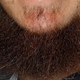 Illustration for article titled Wow! Look Upon Colby Rasmuss Beard, And Pukeem/em